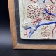 Rare ancienne planche anatomique en relief papier maché Dr Auzoux